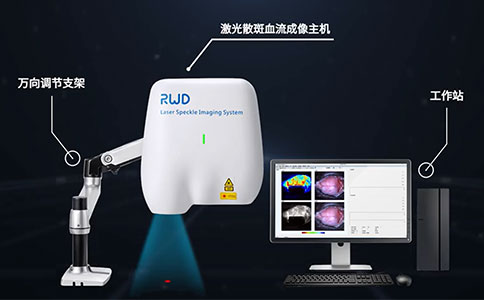 激光散斑血流成像系统 激光散斑血流成像系统