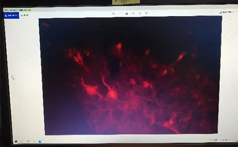 做光纤记录实验采不到荧光信号?注意事项在这里 做光纤记录实验采不到荧光信号?注意事项在这里