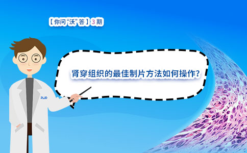 肾穿组织的最佳制片方法如何操作? 肾穿组织的最佳制片方法如何操作?
