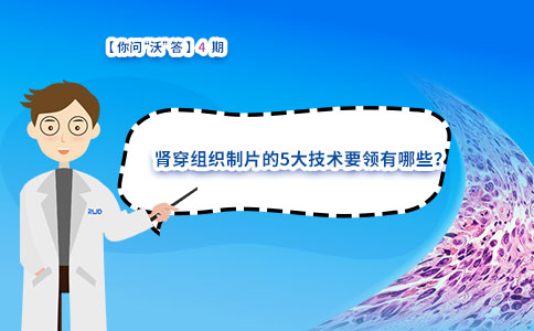 肾穿组织制片的5大技术要领有哪些? 肾穿组织制片的5大技术要领有哪些?