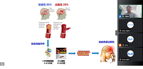 大成学堂 | 卒中研究系列讲座3期精彩全放送!让你一次就学透! 大成学堂 | 卒中研究系列讲座3期精彩全放送!让你一次就学透!