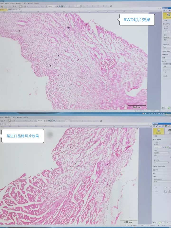 切片对比2 切片对比2