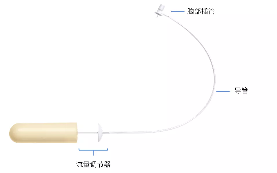 导管连接、灌充和孵育 导管连接、灌充和孵育