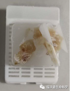 组织发生裂隙破碎或崩脱 组织发生裂隙破碎或崩脱