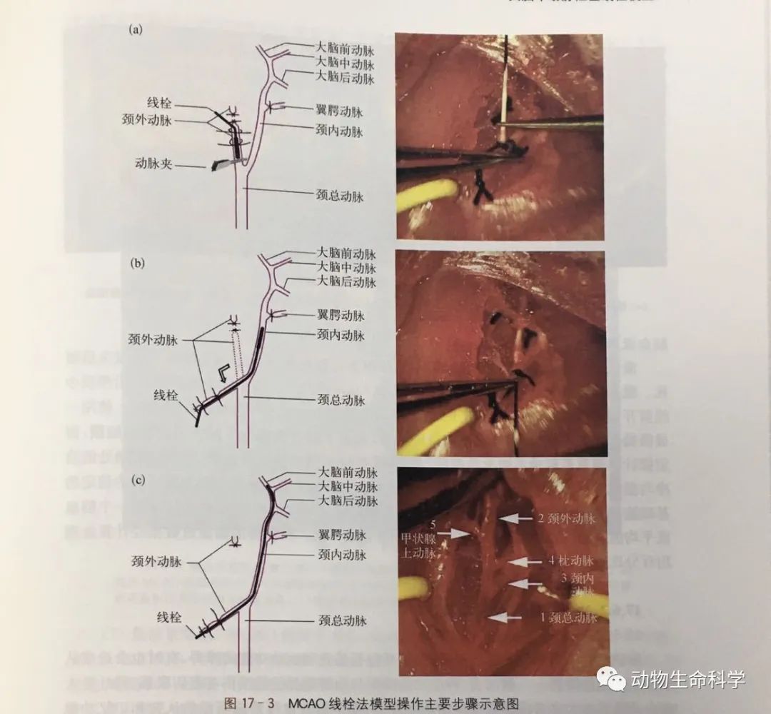 线栓法模型操作主要步骤 线栓法模型操作主要步骤