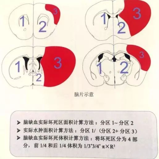 TTC染色 TTC染色