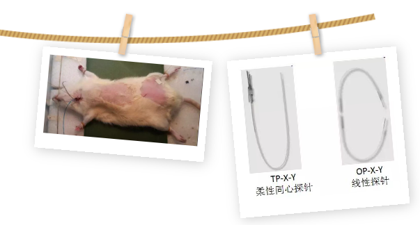 皮肤透析 皮肤透析