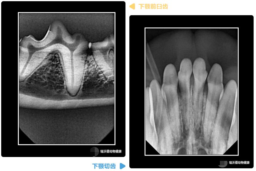 牙齿DR 牙齿DR
