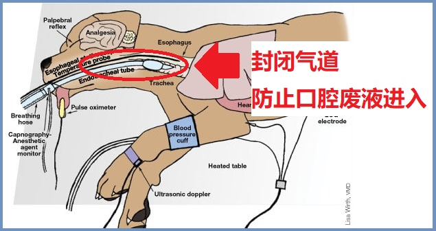 气管插管 气管插管