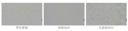 快速上手高质量肿瘤样本单细胞悬液制备 快速上手高质量肿瘤样本单细胞悬液制备