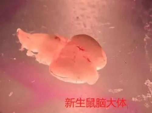 原代皮层和海马神经元培养实验全解析 原代皮层和海马神经元培养实验全解析