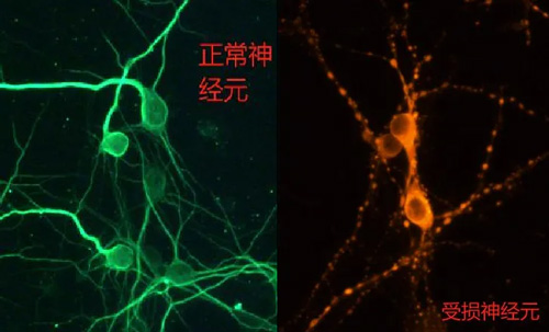 原代皮层和海马神经元培养实验全解析 原代皮层和海马神经元培养实验全解析