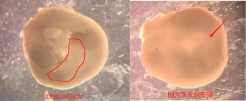 原代皮层和海马神经元培养实验全解析 原代皮层和海马神经元培养实验全解析