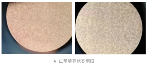 小鼠单核巨噬细胞RAW264.7培养注意事项 小鼠单核巨噬细胞RAW264.7培养注意事项