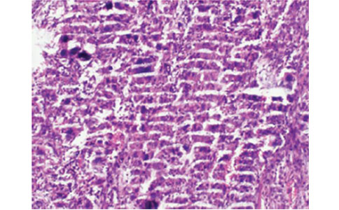 石蜡切片制作有这些问题，如何补救