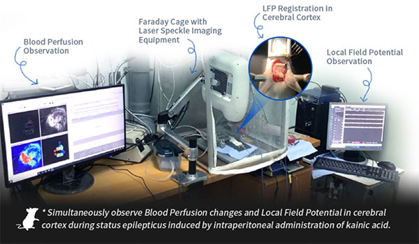 必威官方首页官网betway激光散斑血流成像系统使用分享