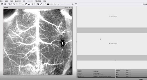 必威官方首页官网betway激光散斑血流成像系统使用分享