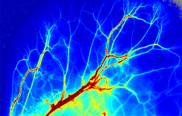 必威官方首页官网betway激光散斑血流成像系统使用分享