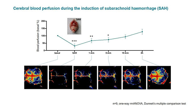 必威官方首页官网betway激光散斑血流成像系统使用分享