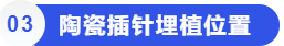 陶瓷插针埋植位置.