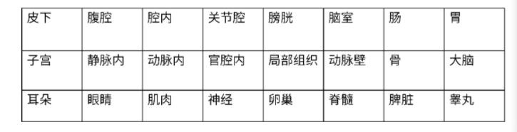 定向输注