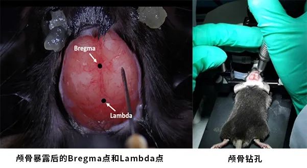 暴露颅骨