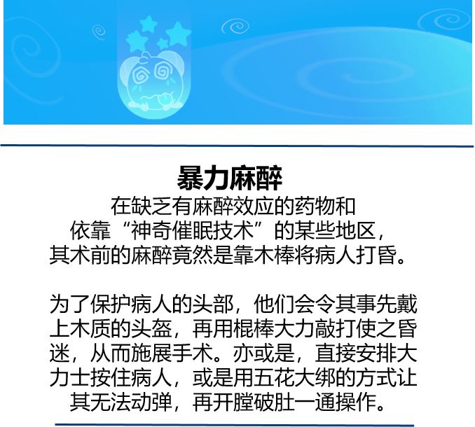 暴力麻醉