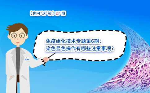 染色显色操作有哪些注意事项